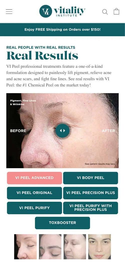 Before-and-after slider